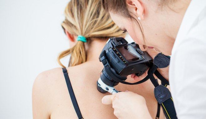 Dermatologist Inspecting Patient Skin Moles