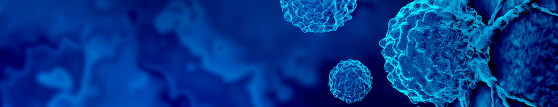 imagen 3D de tumores en azul