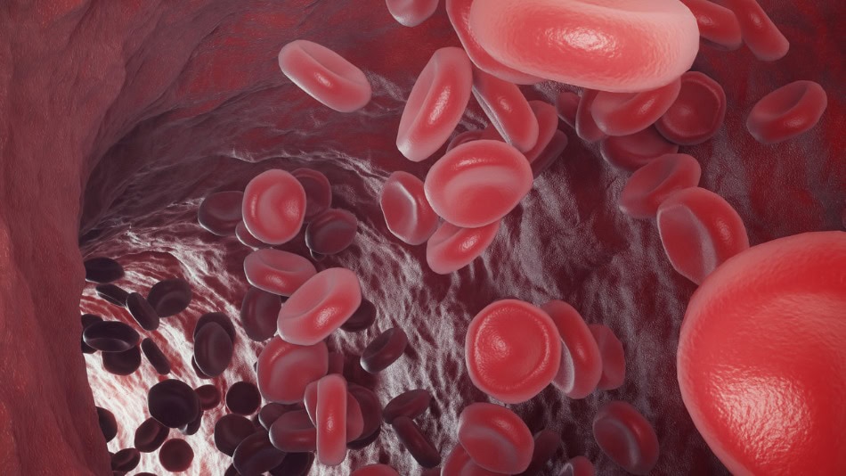 hemoglobinopatías en la sangre