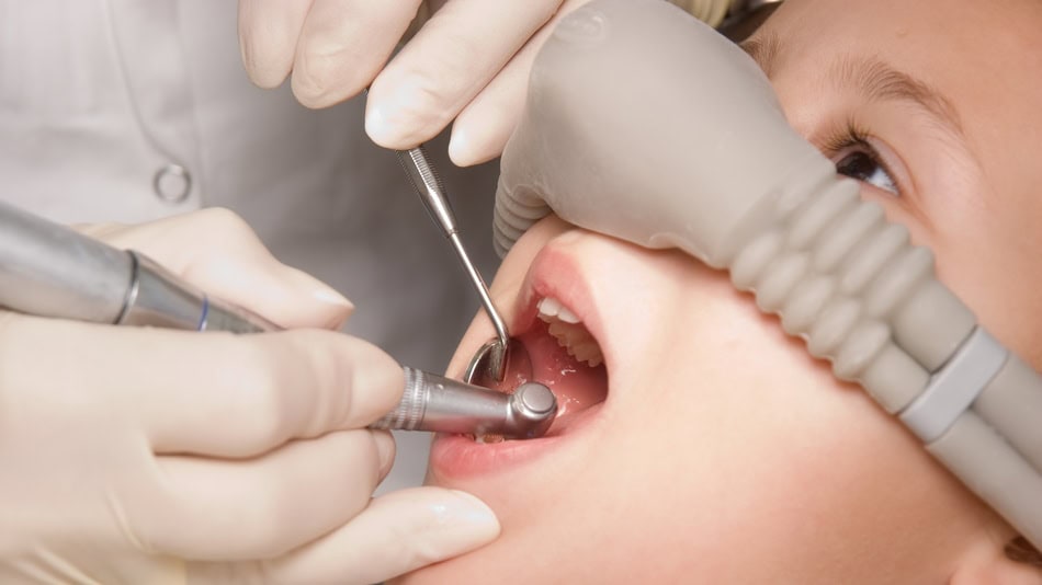 La anestesia local es habitual en procedimientos dentales como los empastes