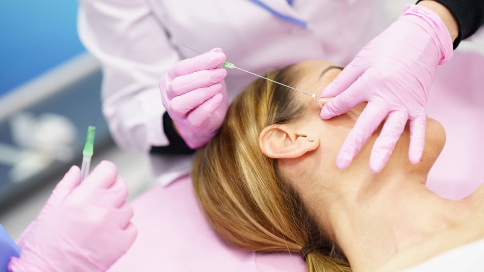 Los hilos tensores faciales son una innovadora solución para rejuvenecer el rostro y realzar la belleza