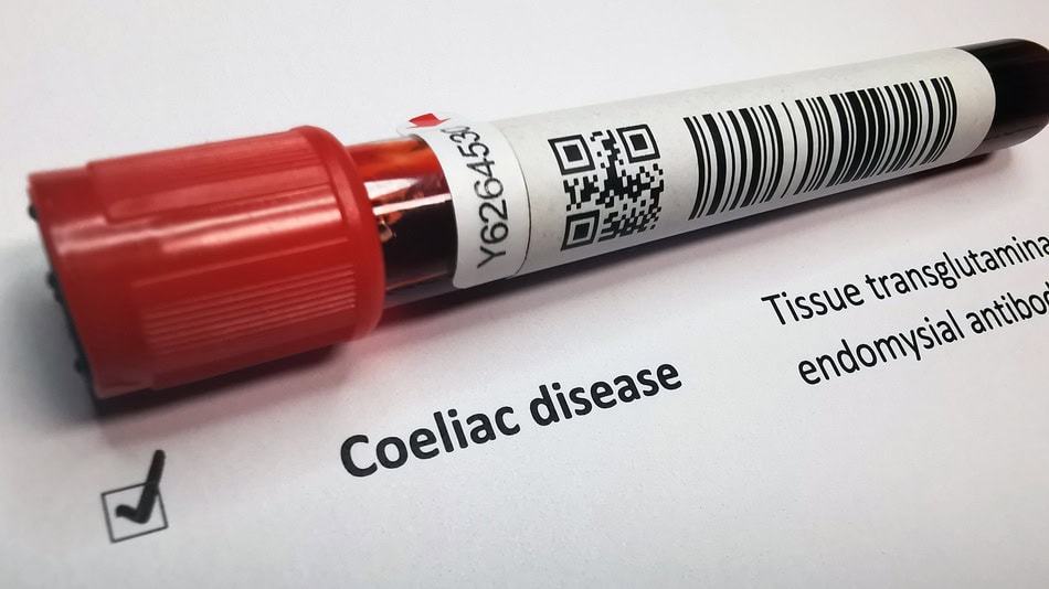 Existen pruebas diagnósticas que ayudan a identificar la celiaquía como análisis de sangre y pruebas genéticas