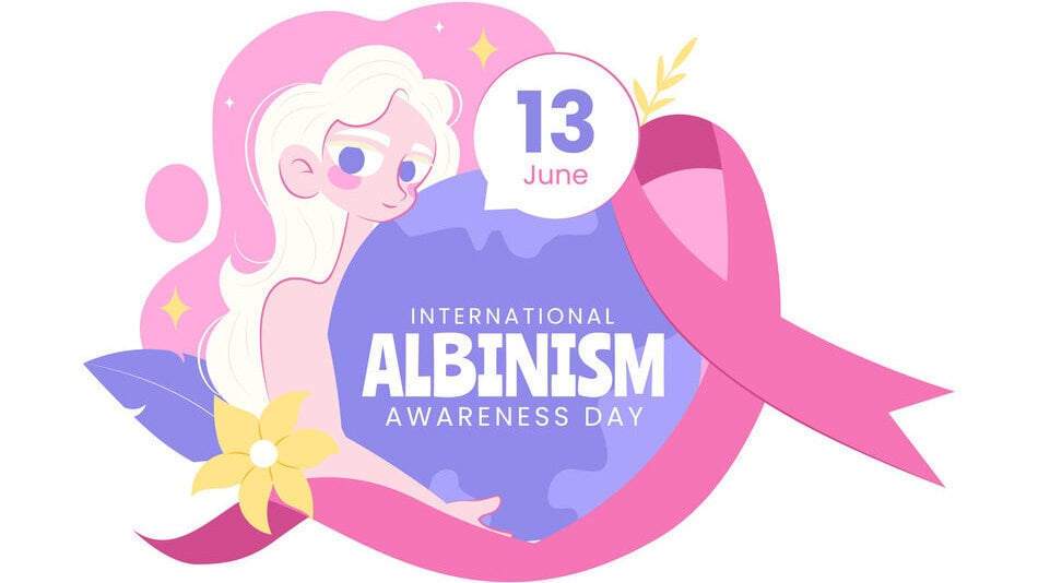 Ilustración vectorial del Día Internacional de Concienciación sobre el Albinismo el 13 de junio