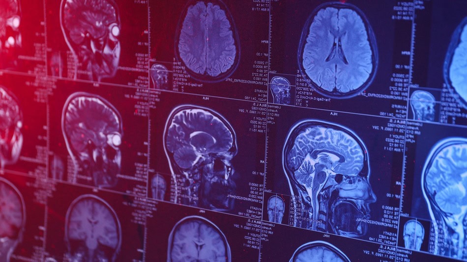 Desde el año 2014, cada 22 de julio se celebra el Día Mundial del Cerebro