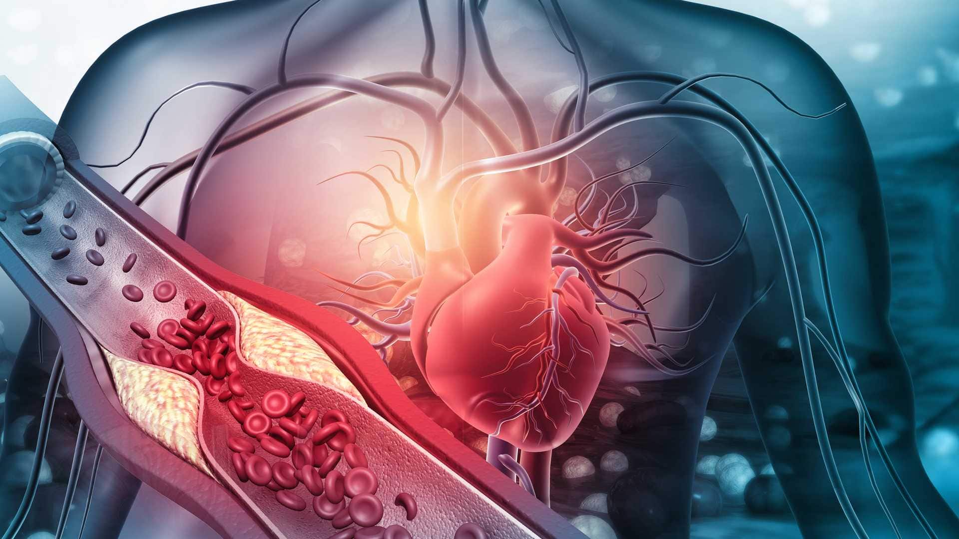 Cabecera América Latina frente a las ENT
