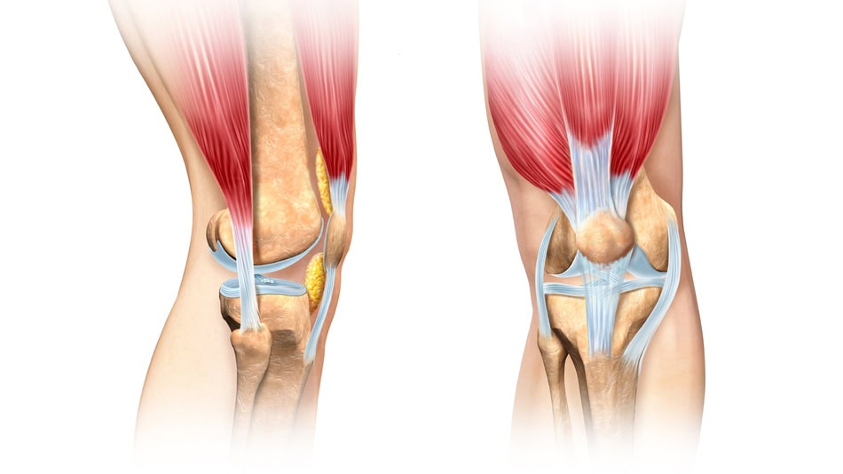 Para curar el tend&oacute;n rotuliano hay que tener paciencia