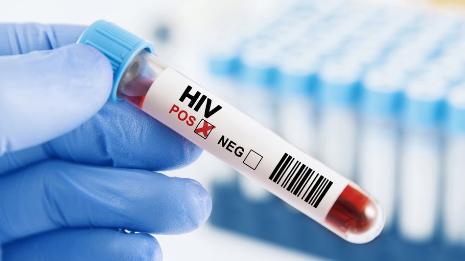 una comunicaci&oacute;n clara sobre la diferencia entre VIH y SIDA permite comprender que el VIH es una infecci&oacute;n controlable y que el SIDA es una enfermedad prevenible